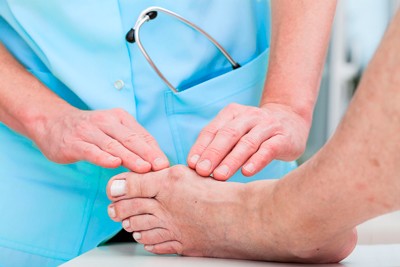 Вальгусна деформація – Hallux valgus або «кісточка на стопі»