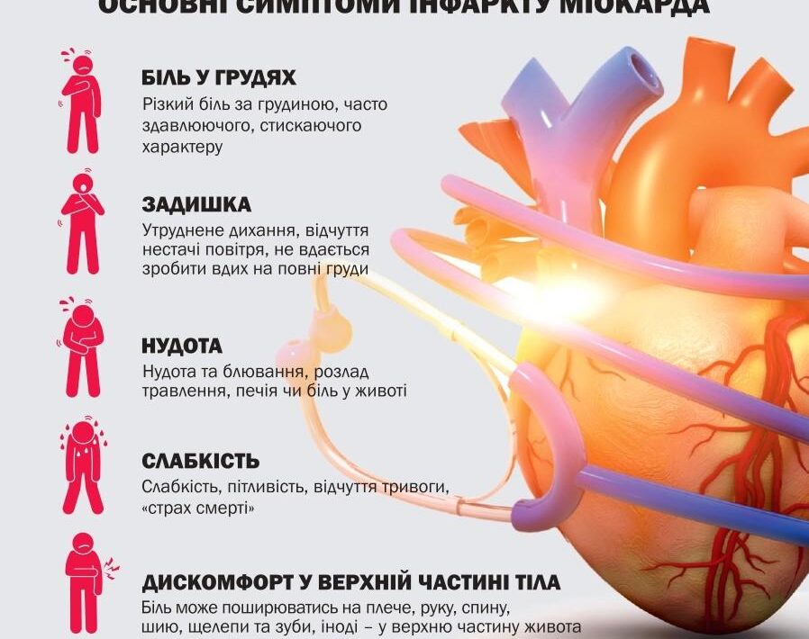 Інфаркт міокарда