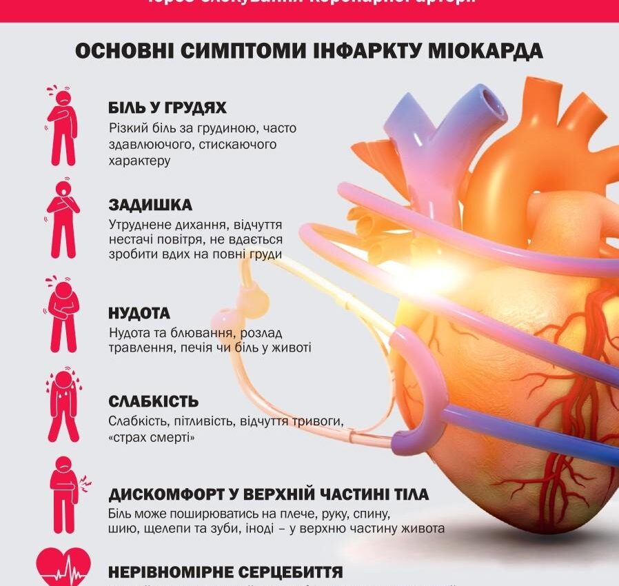 Інфаркт міокарда